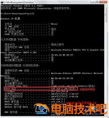 怎样查看电脑ip地址 电脑IP地址如何查看 应用技巧 第2张