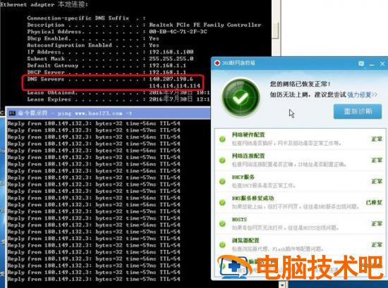 win7dns配置异常怎么办 win7系统DNS服务器未响应 系统教程 第6张